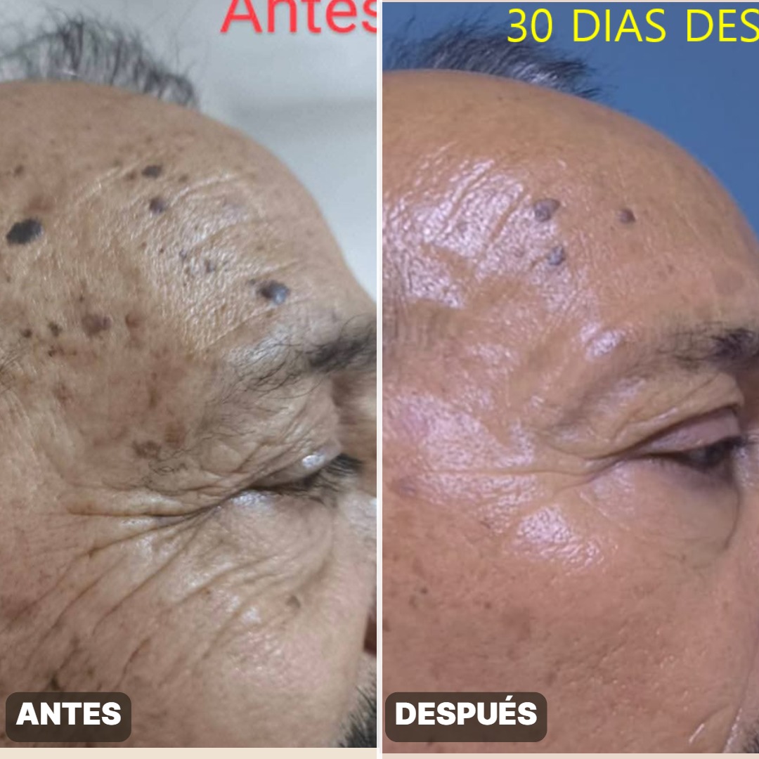 Antes y después — Lineas prooofundas