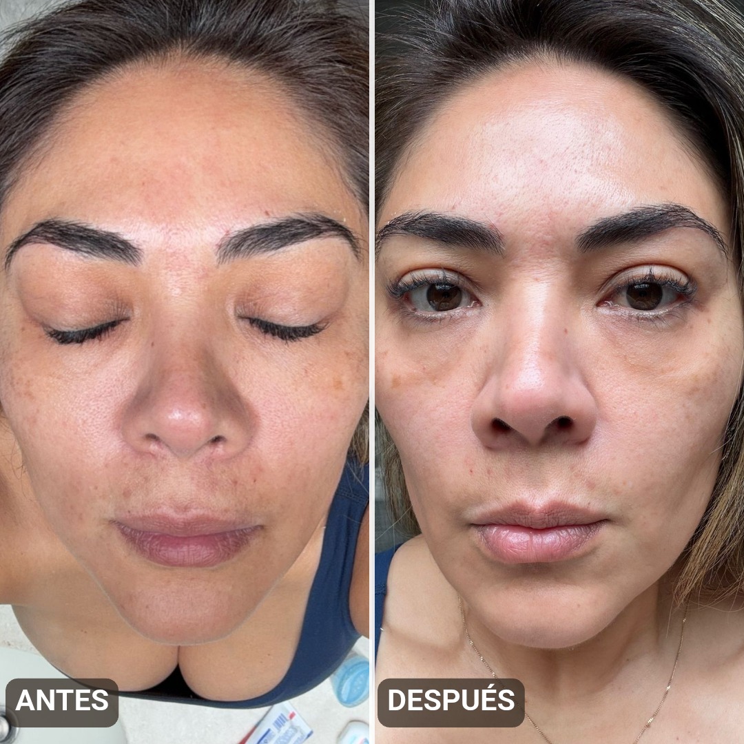 Antes y después — Una aplicación