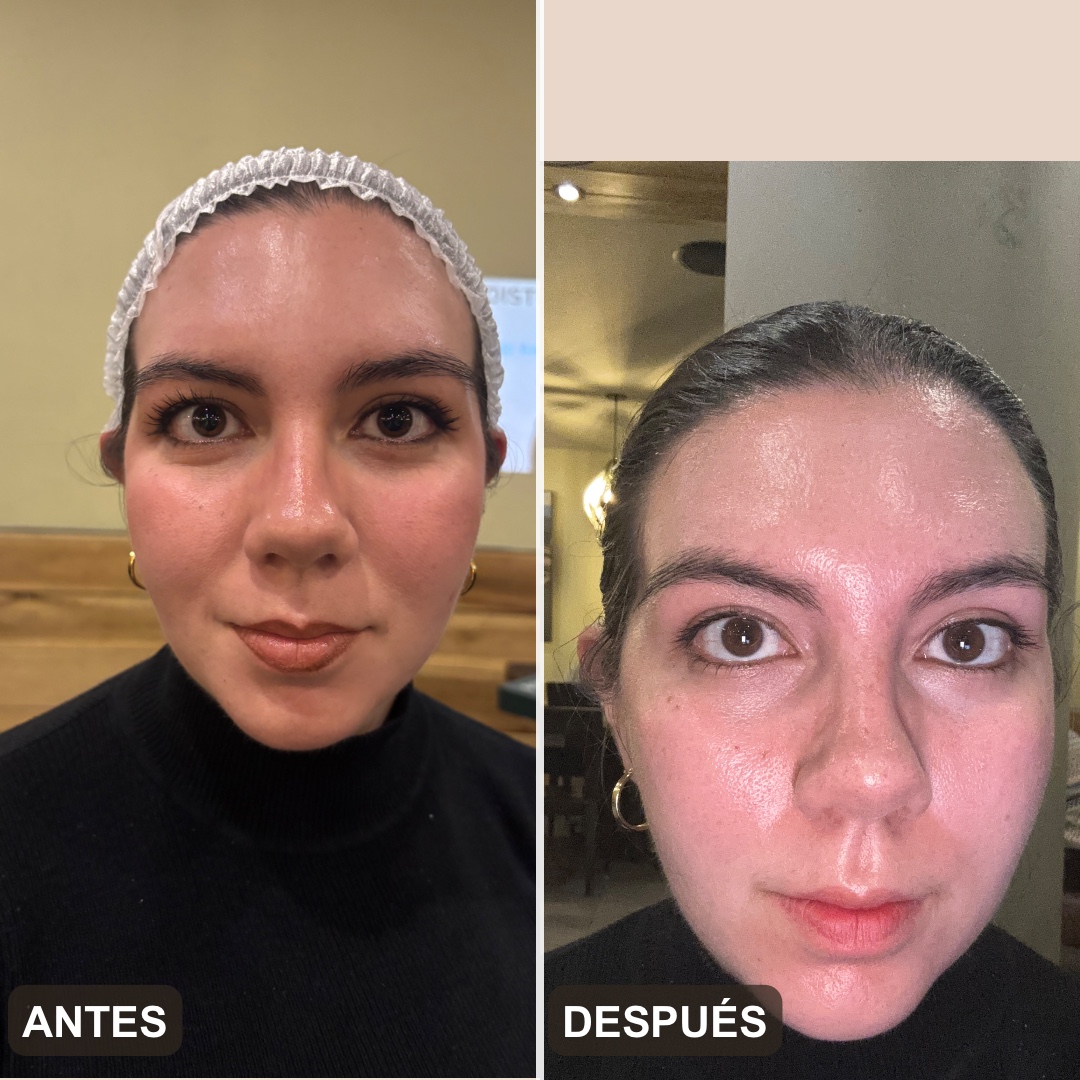 Antes y después — Una sola aplicación